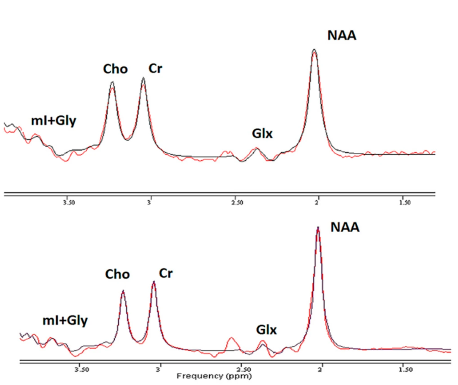 Two published proton MR spectra from the Ghent baseline study, with labelled peaks for mI+Gly, Cho, Cr, Glx and NAA on a ppm axis from about 3.8 to 1.3.